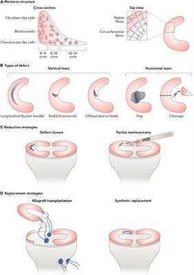 Advances in the Mechanisms Affecting Meniscal Avascular Zone Repair and Therapies